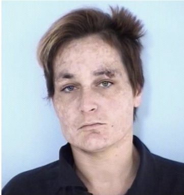 Mug shot of a white female with short brown hair and a sore above her eye wearing a navy blue jumpsuit